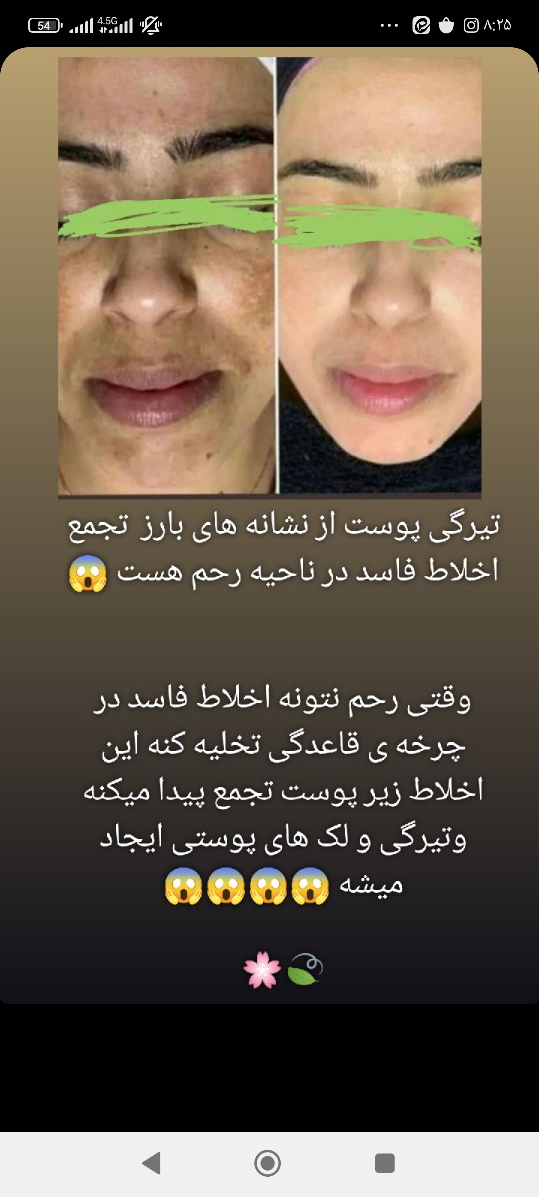 پوست زیبا بدون لک و جوش