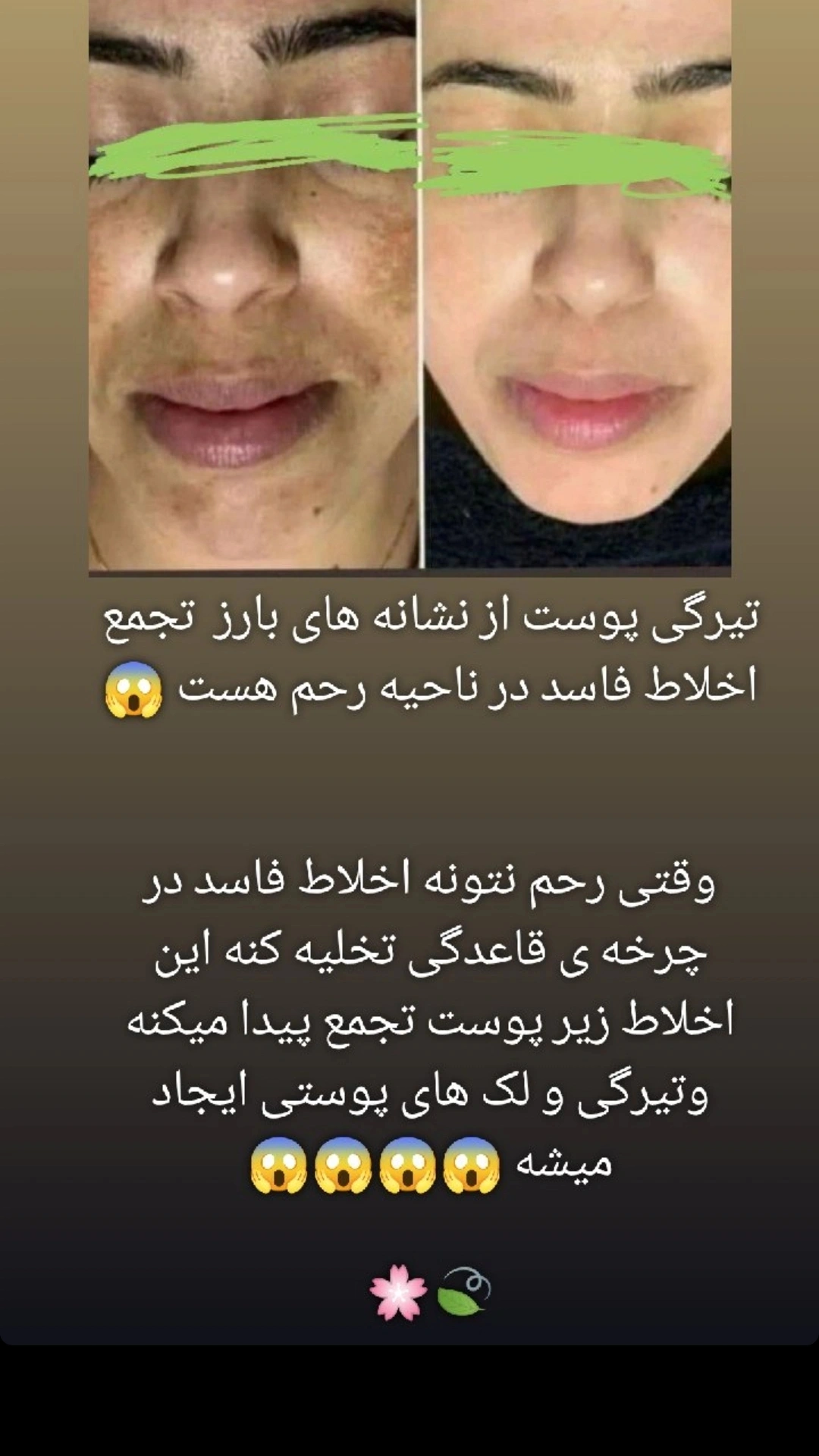 پوست زیبا بدون لک و جوش