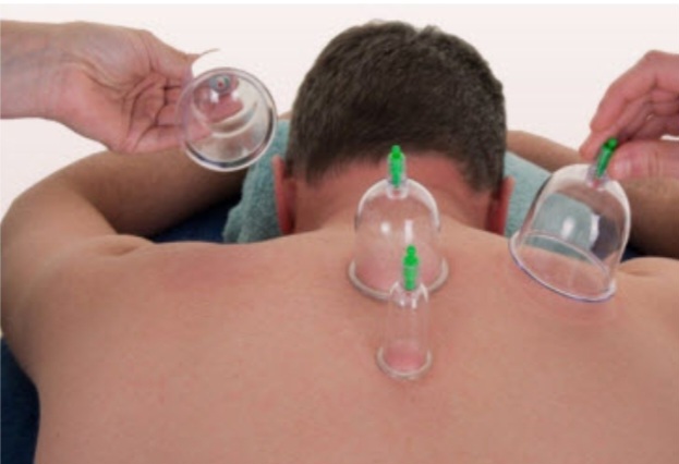 دانلود پاورپوینت حجامت و فواید آن