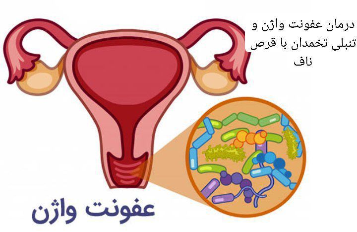 قرص ناف