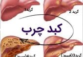 کبد چرب