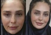 ضدلک صورت روشن کنده صورت