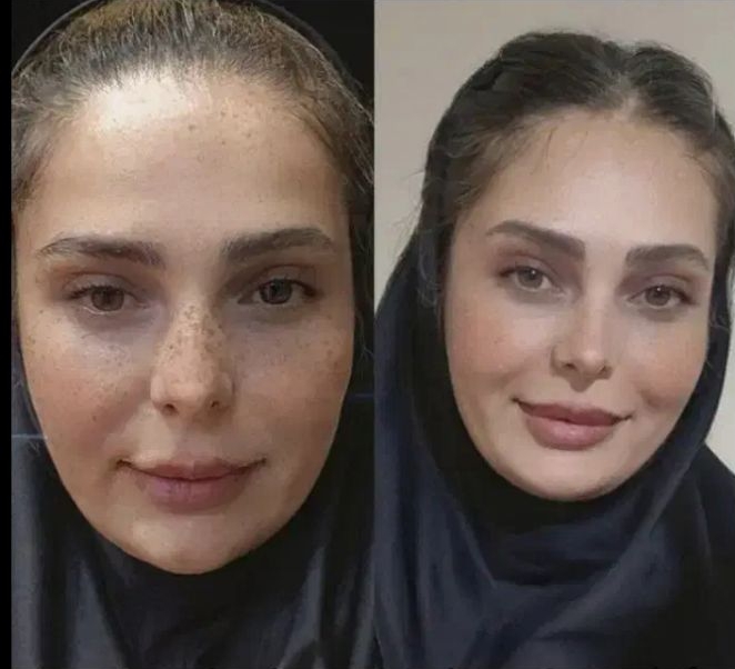 ضدلک صورت روشن کنده صورت